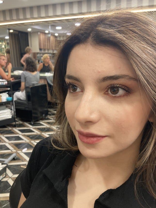 Aysel A. — çalışma 4