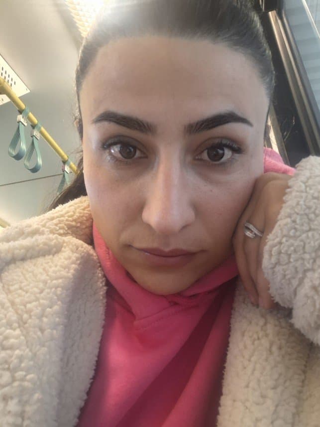 Besra B. — çalışma 1