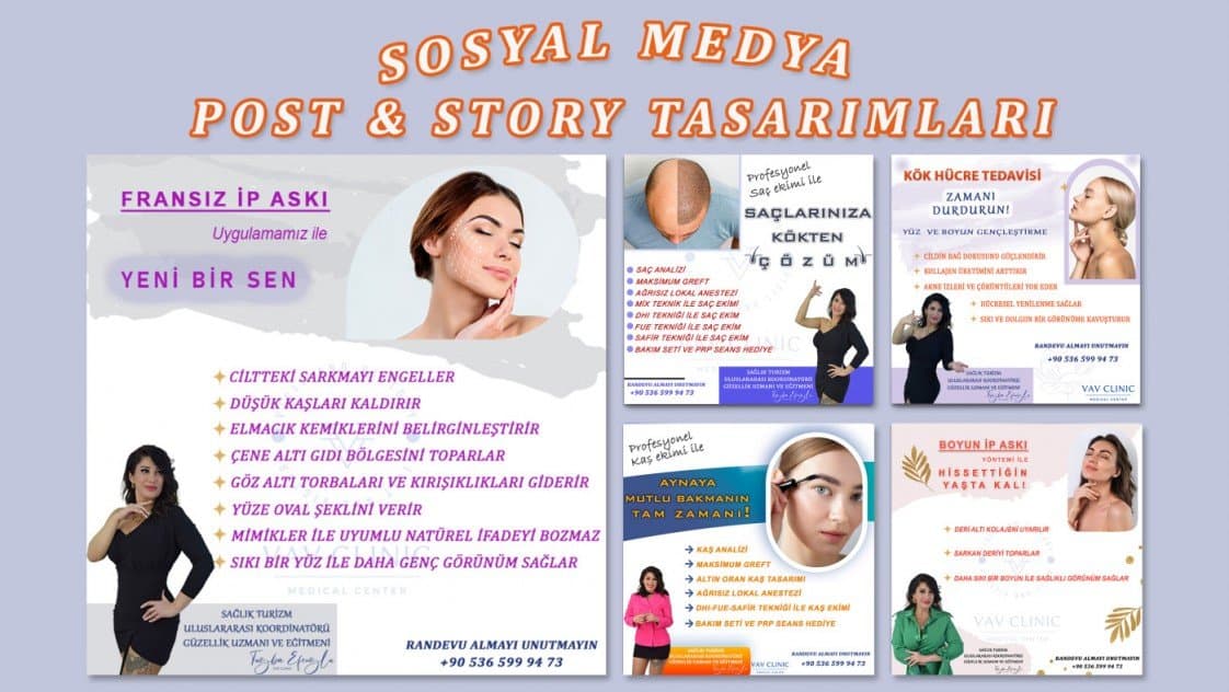 Betül E. — çalışma 8
