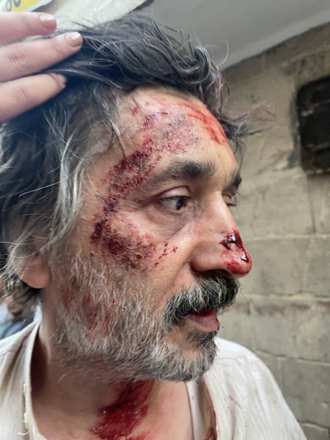 Buğse H. — çalışma 2