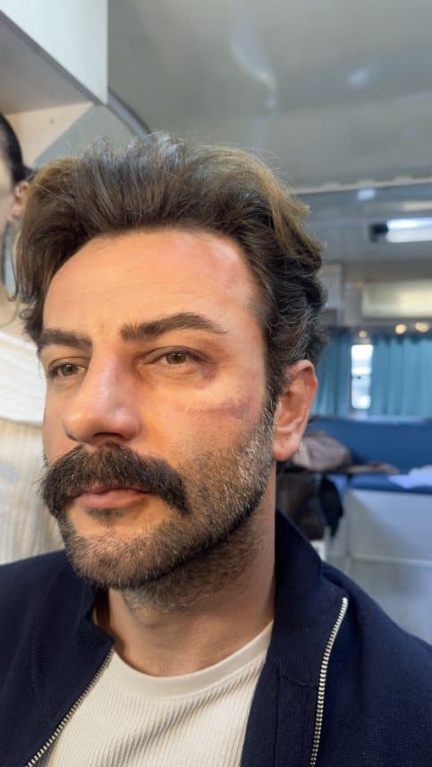Buğse H. — çalışma 5
