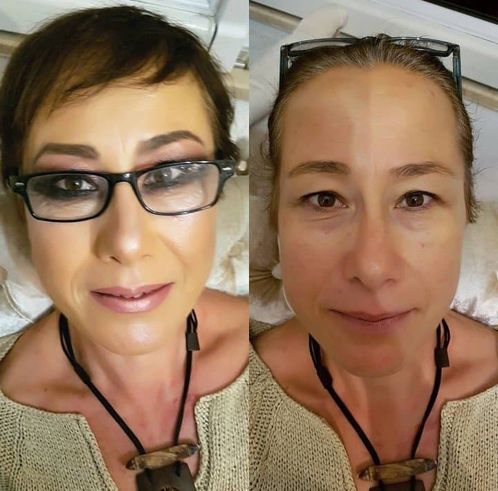 Burcu Ü. — çalışma 3