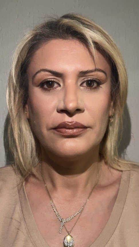 Buse Ç. — çalışma 2