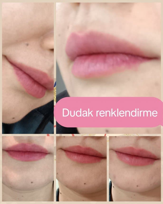 Cholpon E. — çalışma 7