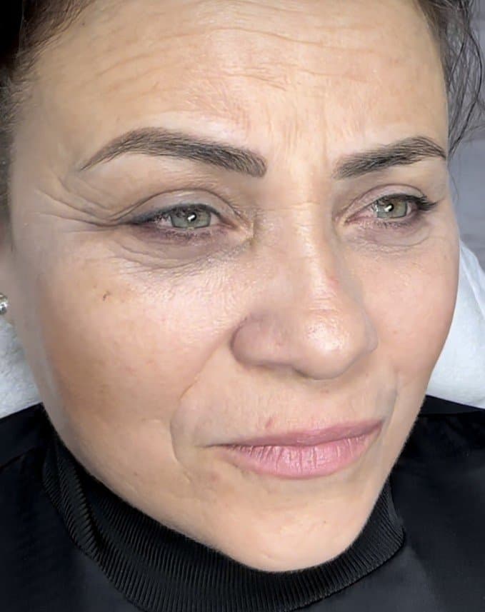 Fehime D. — çalışma 1