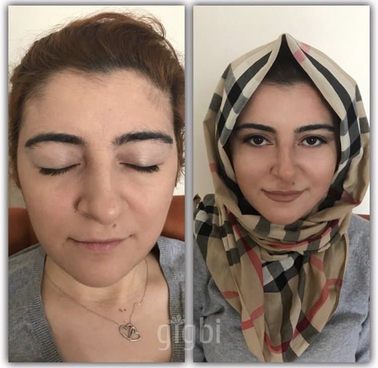 Feyza S. — çalışma 5