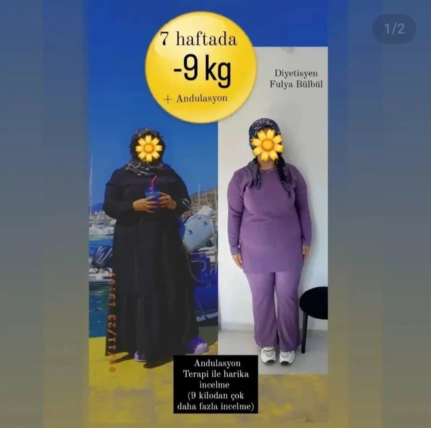 Fulya B. — çalışma 2