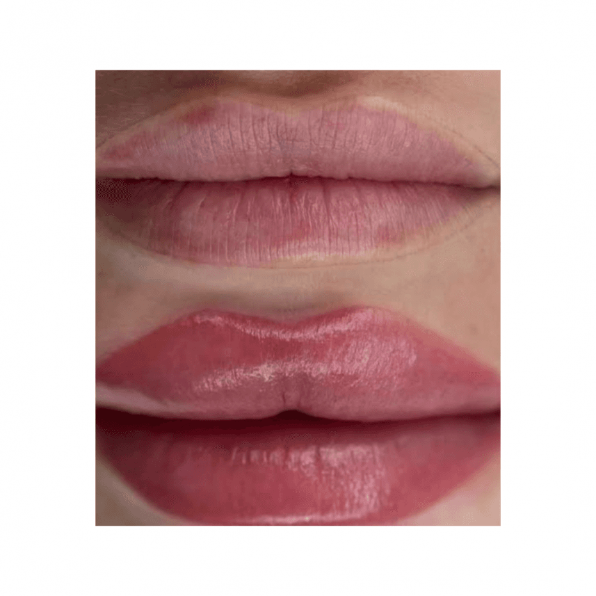 Gülümser Y. — çalışma 7