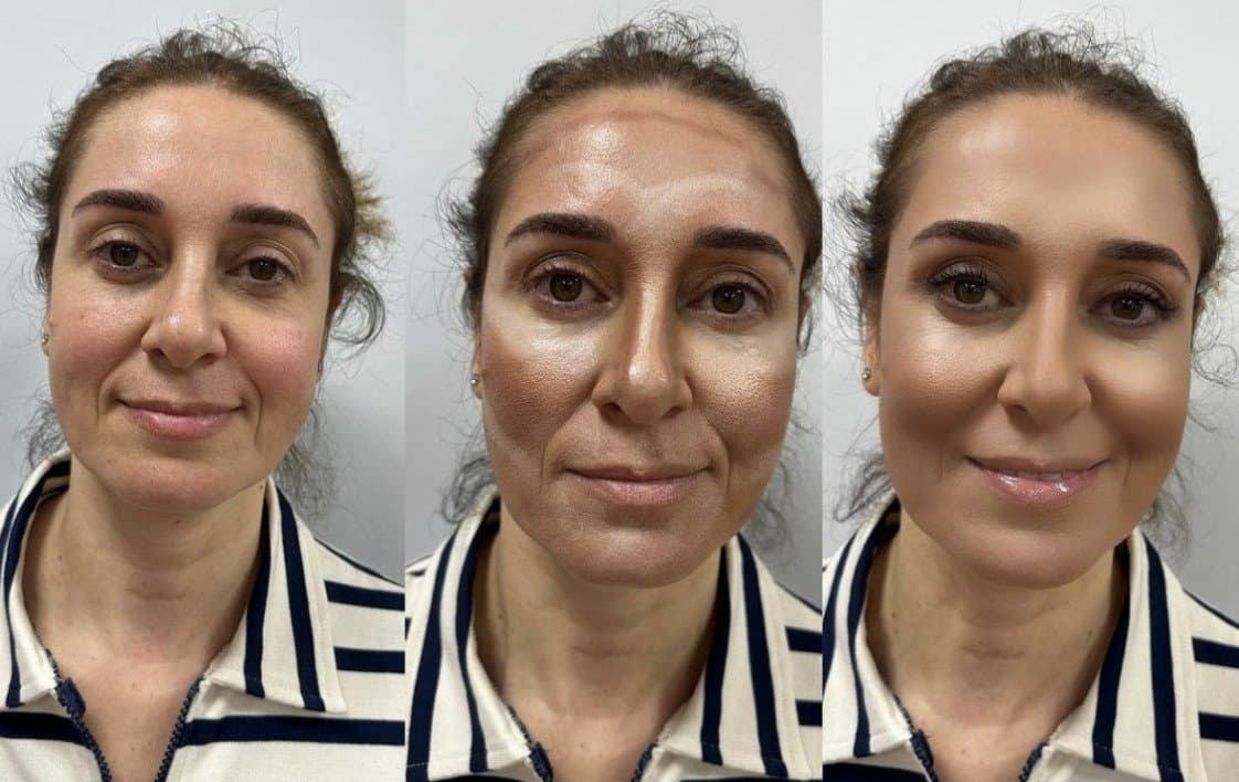 Hülya C. — çalışma 5