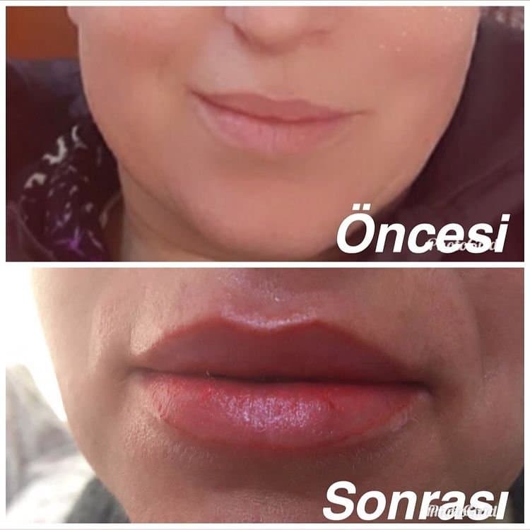 Kamile B. — çalışma 8