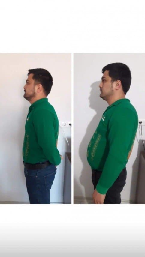 Mehmet A. — çalışma 1