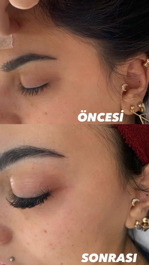 Meltem A. — çalışma 6
