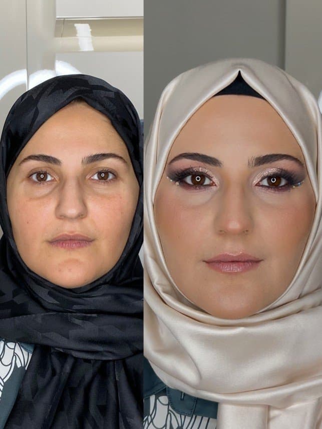 Nurbanu U. — çalışma 2