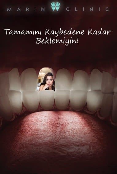 Ozan K. — çalışma 2