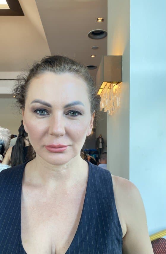 Özge E. — çalışma 3