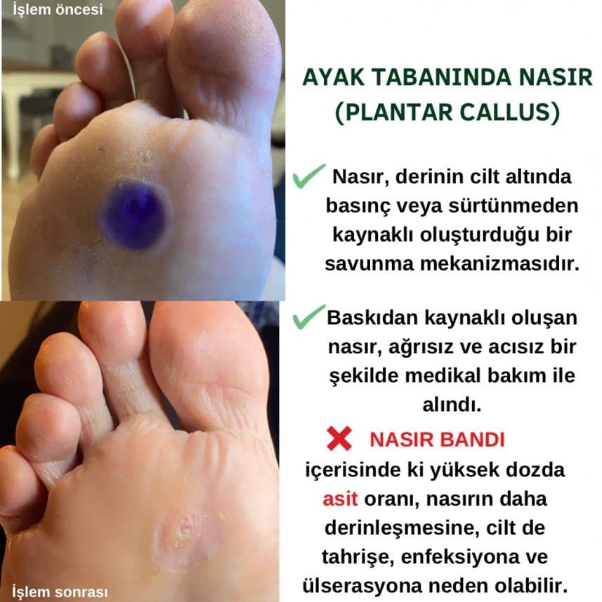 PodoClean — çalışma 2