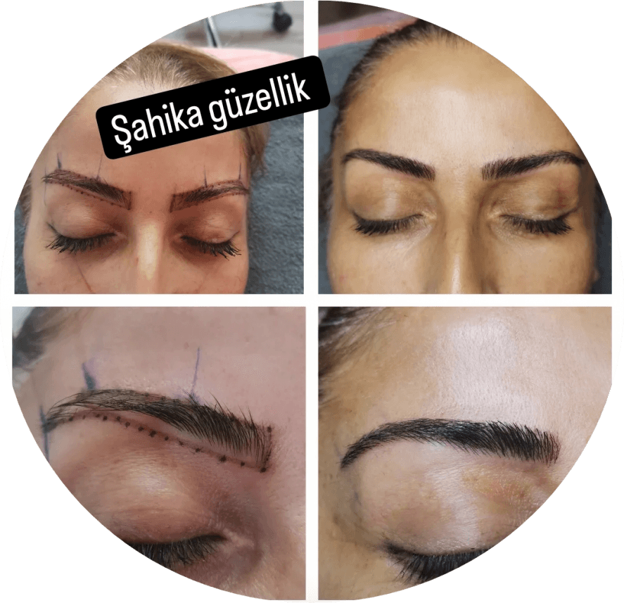 Şahika A. — çalışma 2