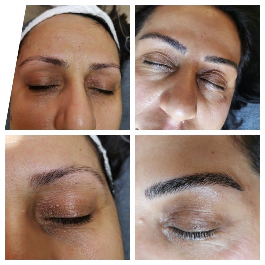 Şahika A. — çalışma 3