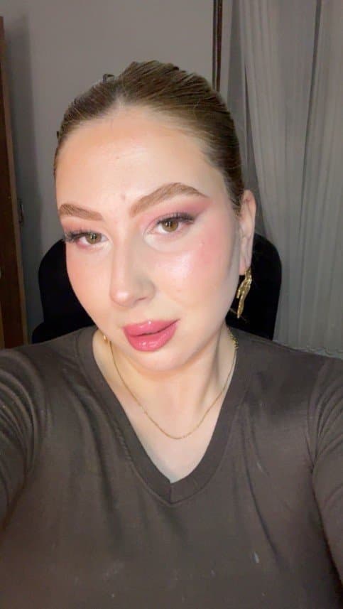 Şengül T. — çalışma 3