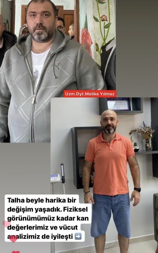 Uzm. Y. — çalışma 2