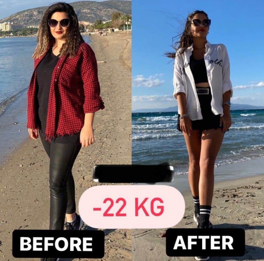 Uzm.Dyt. F. — çalışma 3