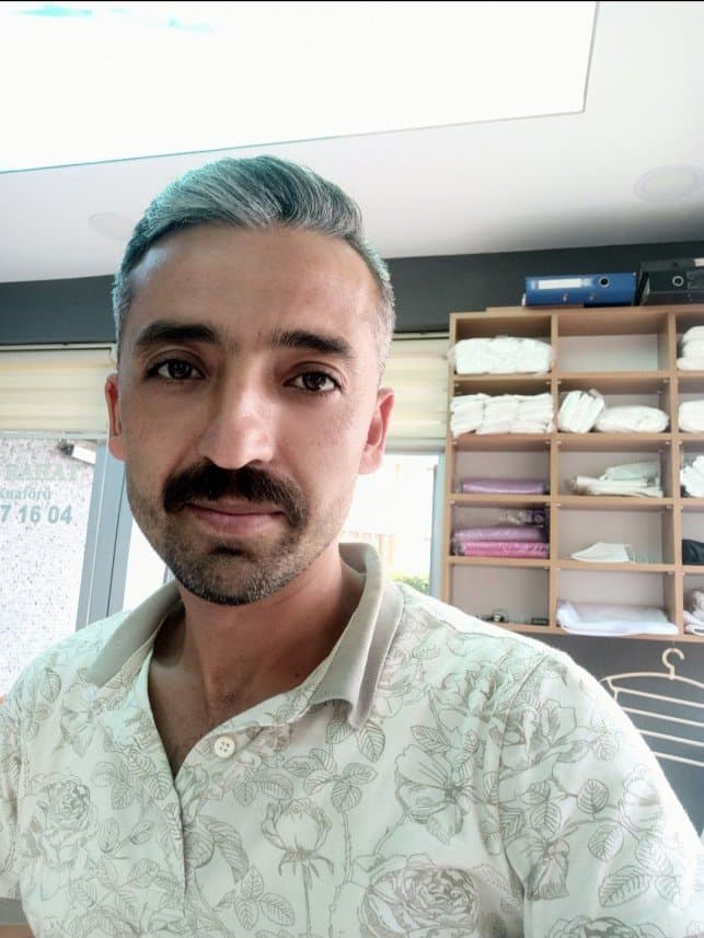 Yıldıray Y. — çalışma 3