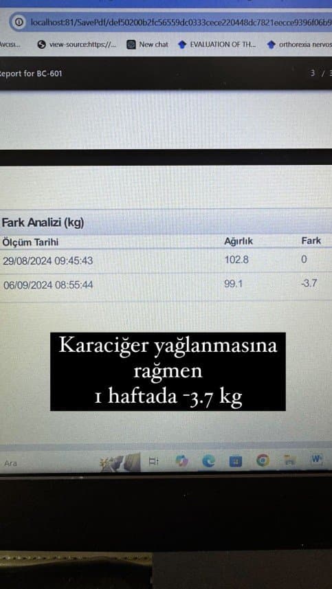 Zekiye H. — çalışma 3