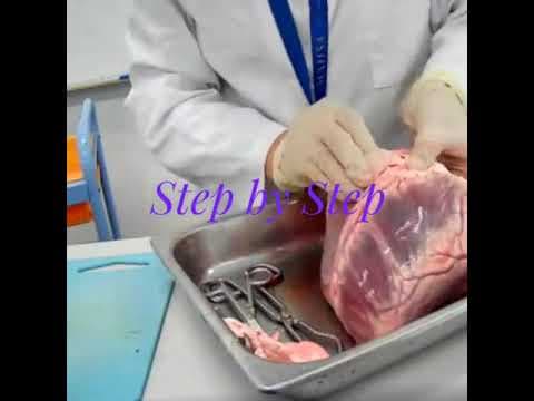 Shekoofeh N. — video 2