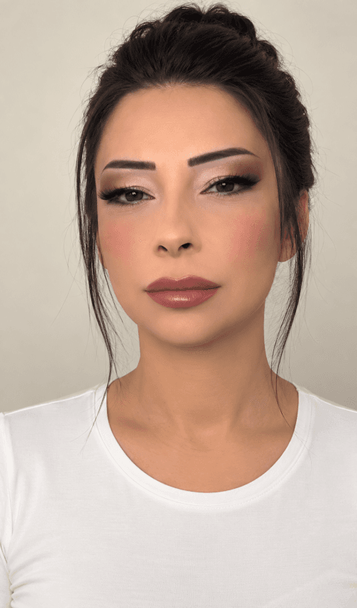 Berra A. — çalışma 3