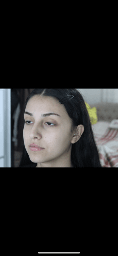 Buse A. — çalışma 1