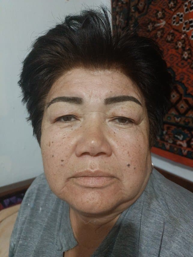 Çolpan E. — çalışma 6