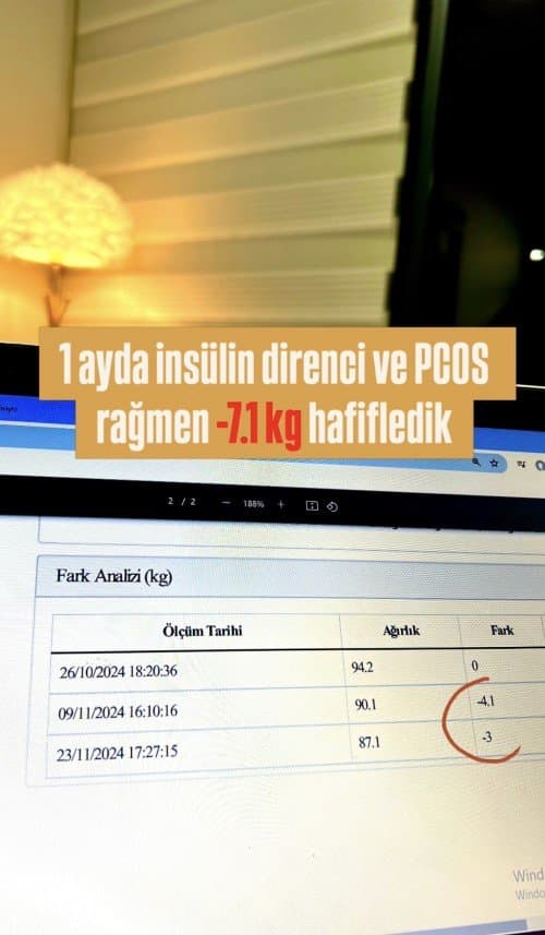Dilara Y. — çalışma 1