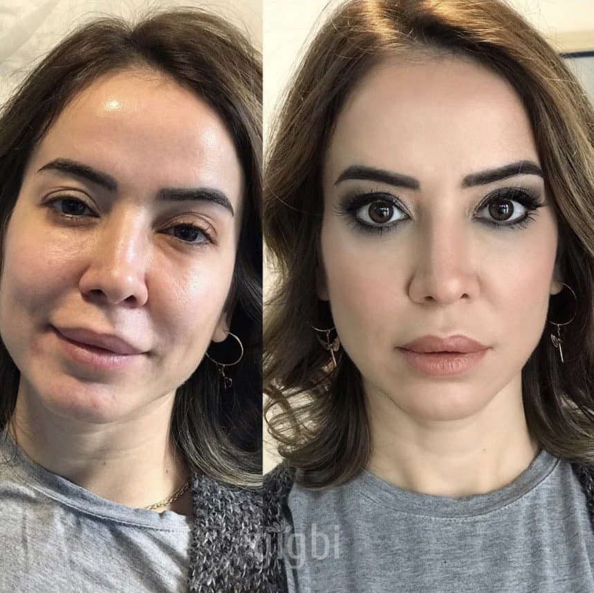Elif M. — çalışma 7