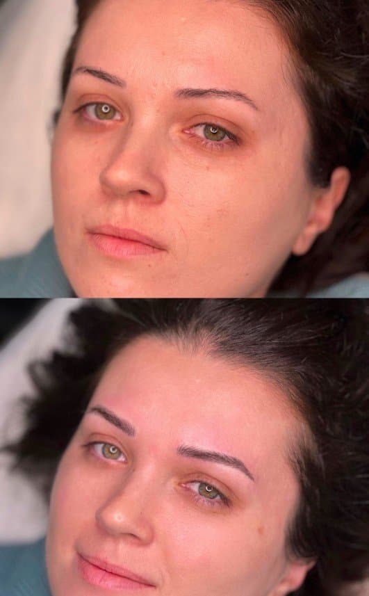 Filiz D. — çalışma 3