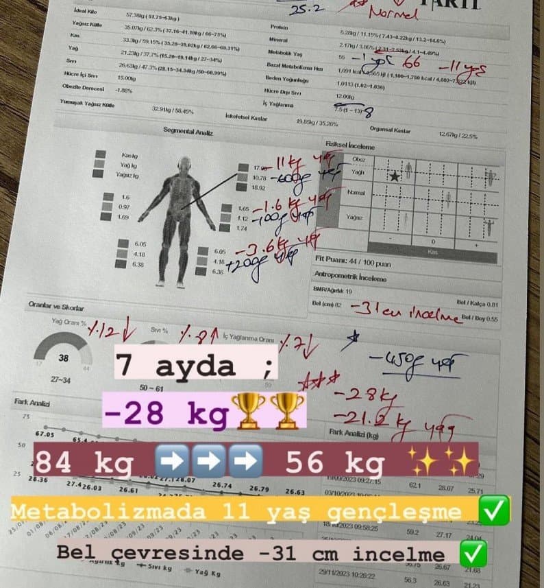 Hacer A. — çalışma 1