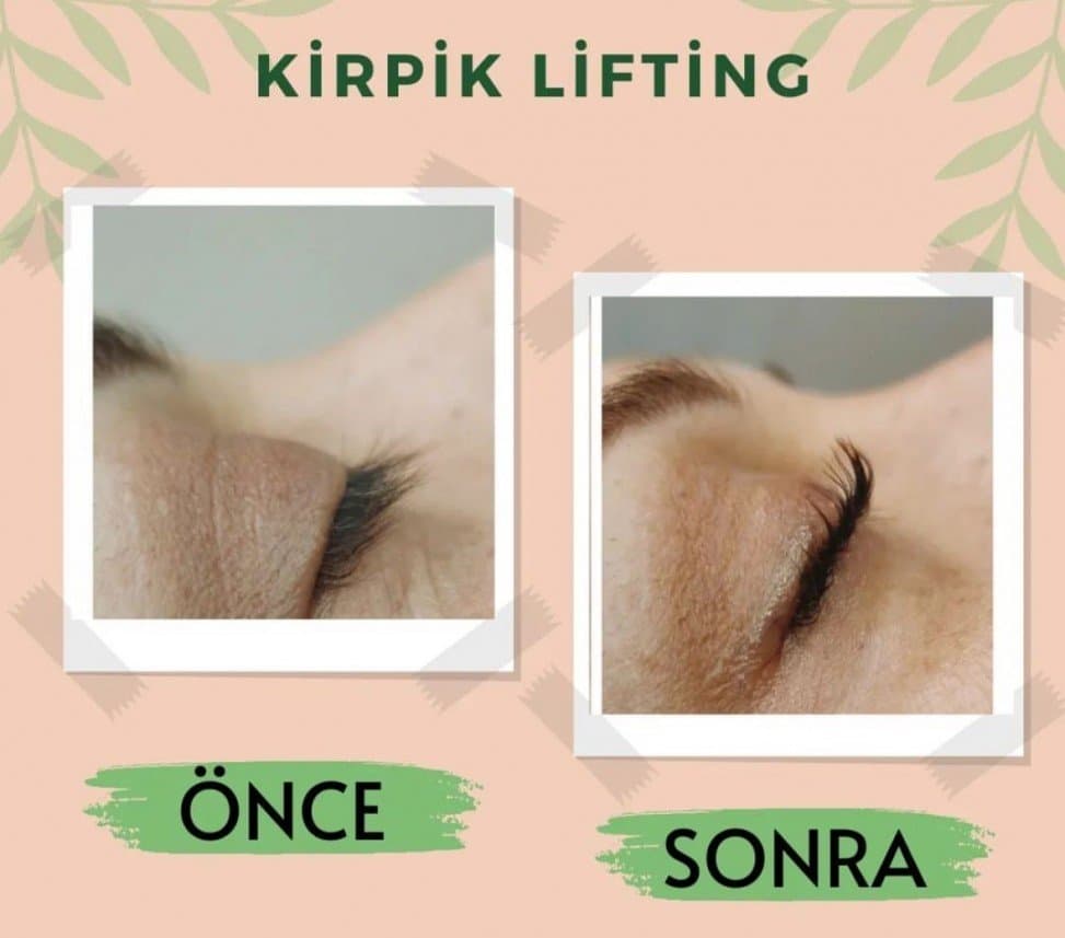 İlknur Ö. — çalışma 3
