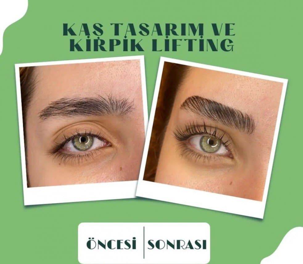 İlknur Ö. — çalışma 4