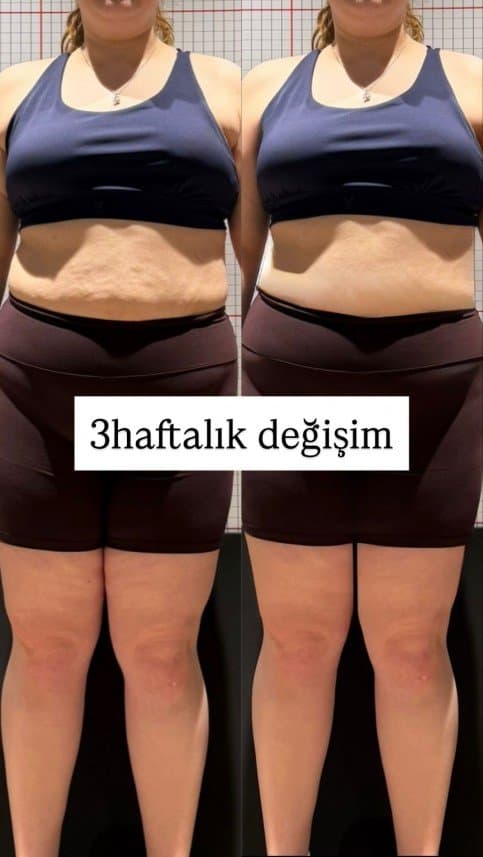 Leyla K. — çalışma 2