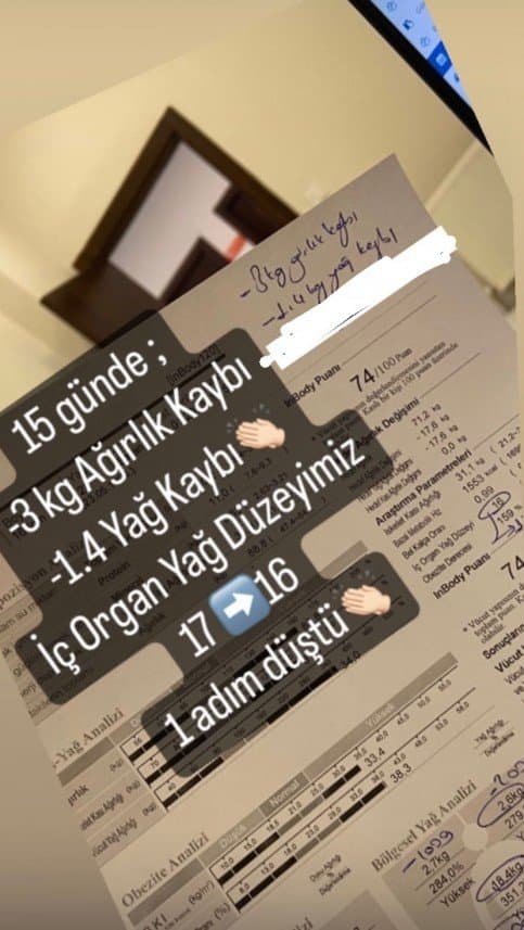Melisa Ş. — çalışma 1