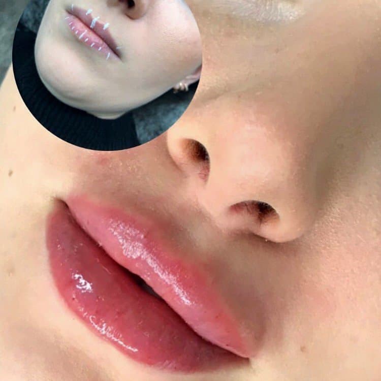 Meryem U. — çalışma 1