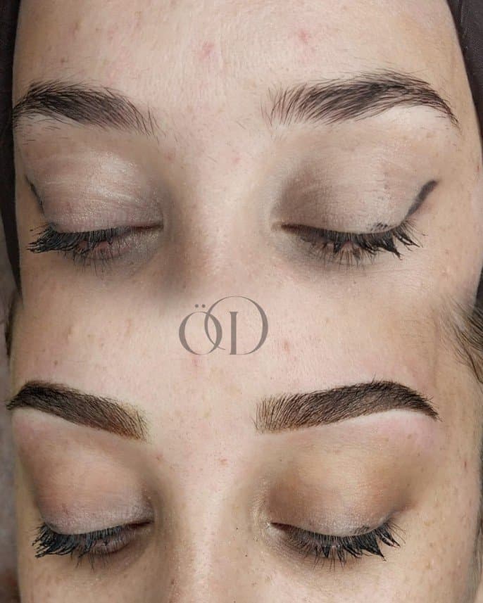 Özge D. — çalışma 3