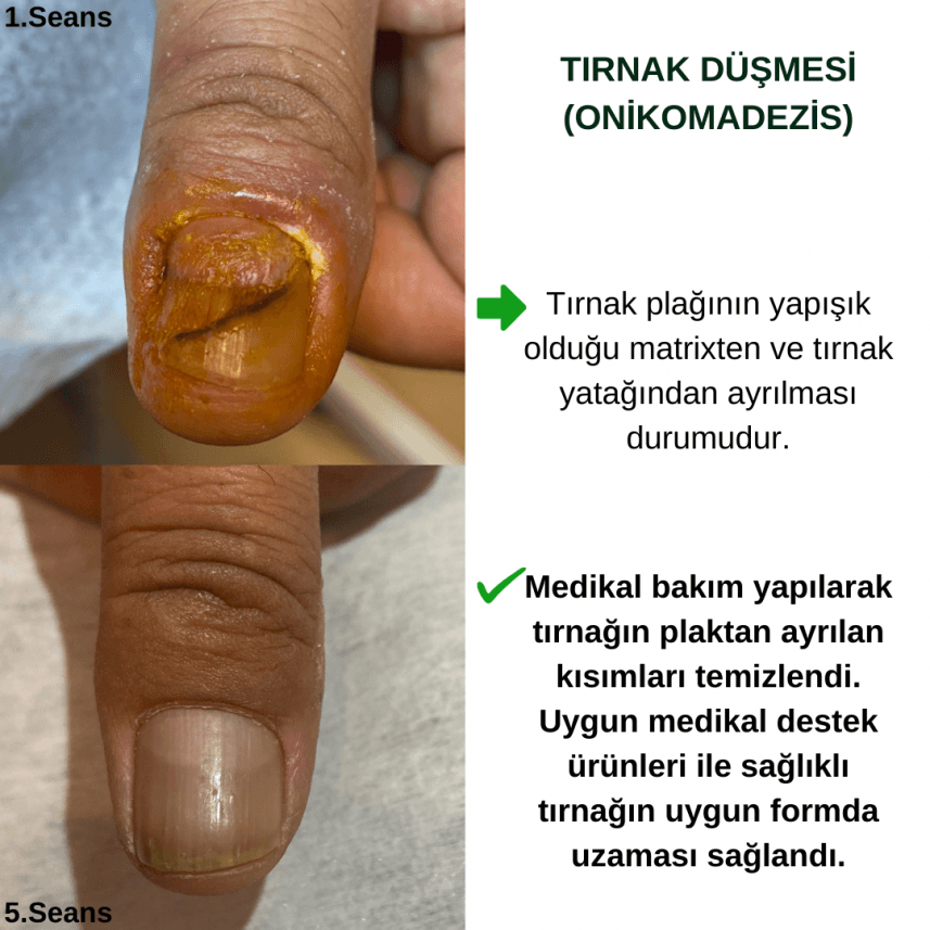 PodoClean — çalışma 7