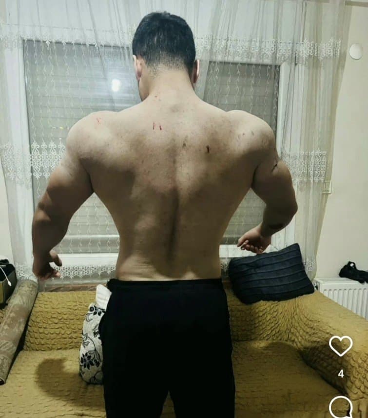 Turan Y. — çalışma 2