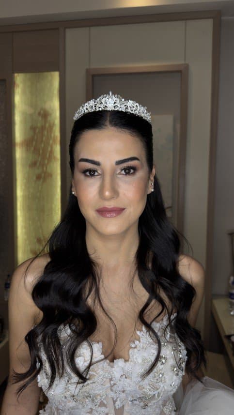 Onur Y. — çalışma 3