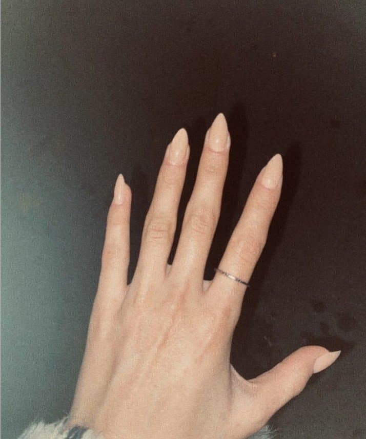 Yüsra Y. — çalışma 1