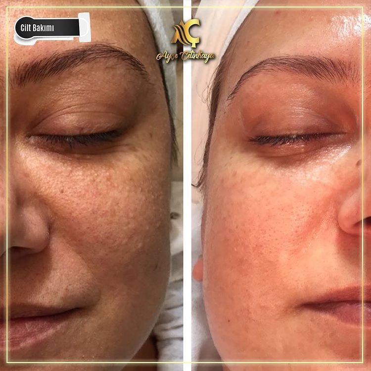 Ayşe Çetinkaya Beauty