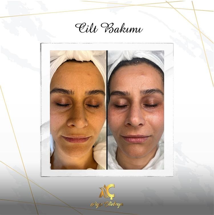 Ayşe Çetinkaya Beauty