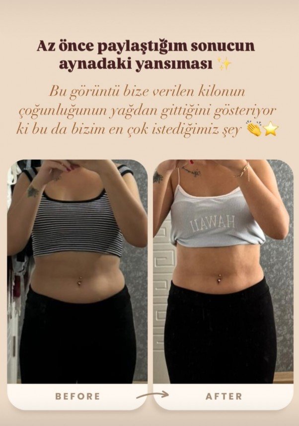 Diyetisyen Beyza Soydan