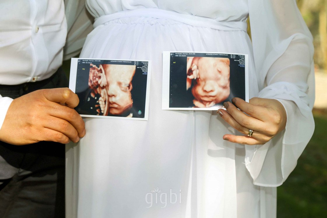 Damla Demir Photography