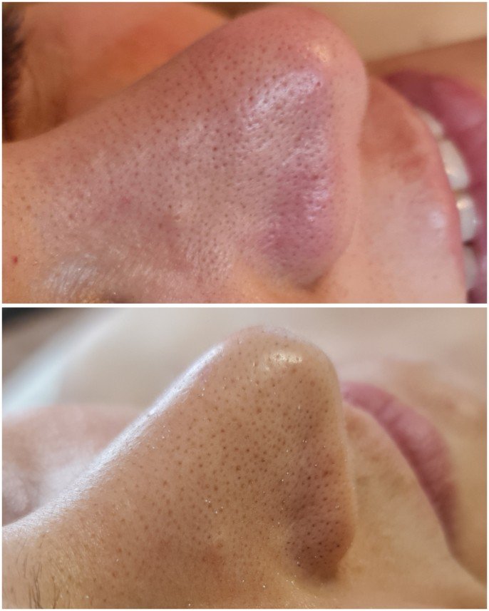 Elif Çalık Beauty & Academy